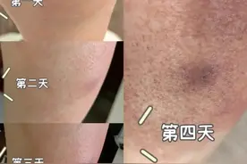 红火蚁进入活跃期，已入侵12个省份，有致命危险！紧急提醒图片