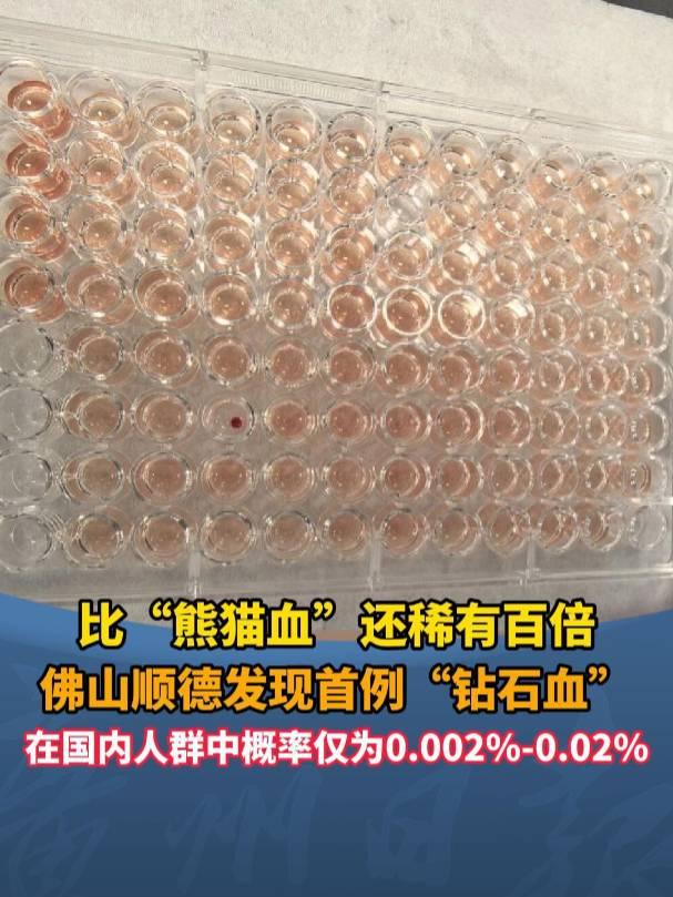 广东顺德发现一例“钻石血”