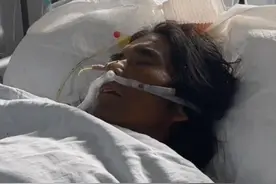“面筋哥”完成肝移植手术已苏醒，弟弟：去年在某平台收入7144元图片