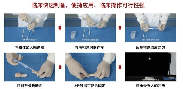 对话｜全球首款“骨胶水”研发团队：可实现断骨三分钟黏合