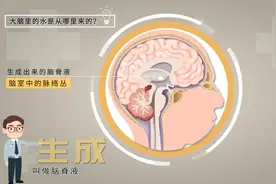 视频丨有问医答：脑子里的“水”该怎么治？图片