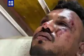 印度空难唯一幸存者：座位紧邻舱门 坠机后立刻拨通父亲电话图片