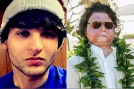 全球首例同时换脸换手男子结婚：与大他12岁的护士网上相识，婚礼还有粉丝道贺图片