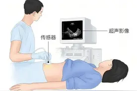 【朝医科普】卵泡发育周期的超声观察图片