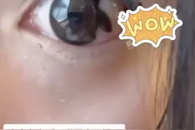 女子火车上一觉醒来吓坏了！眼睛里的它碎了……图片