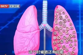 闻了闻刚脱下的袜子，竟感染真菌肺炎？3个行为风险加倍！赶紧自查图片