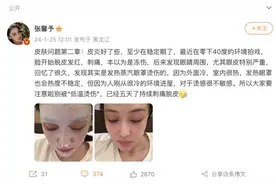 女演员自曝：“持续刺痛”！不少人都在用，没想到竟成“伤人暗器”图片