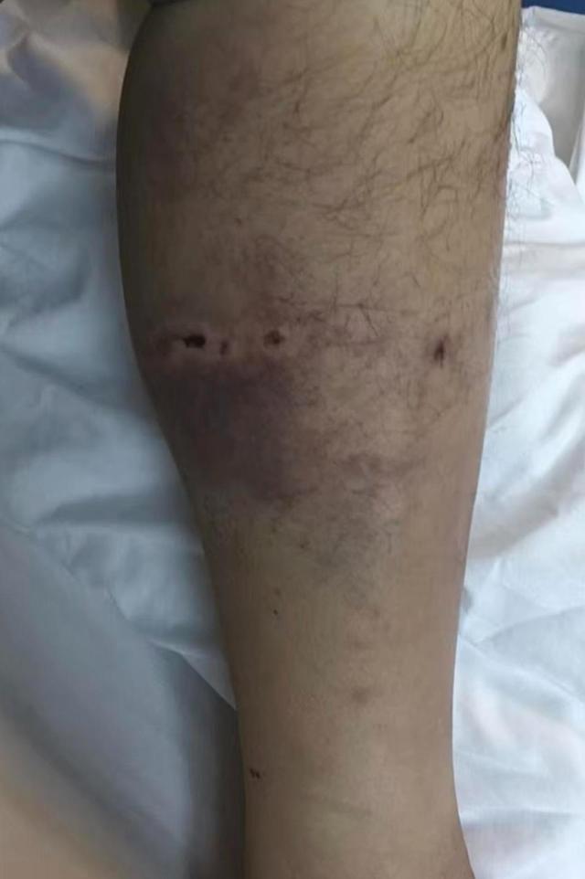 被熊袭击能装死吗？秋季“熊出没”如何避险→