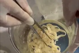 女子体内排出10米长绦虫 原是两年前旅游时吃了生牛肉图片