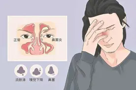 “始作俑者”是真菌性鼻窦炎图片