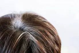 白头发越长越多？可能是缺这3种营养了！图片