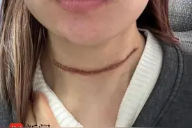 女生参赛被风筝线“割喉”！组委会签了《免责协议》就能免责吗？律师解读图片