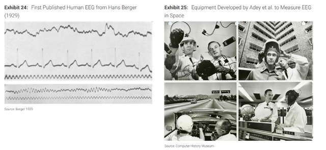 脑机接口——人与AI“共生”