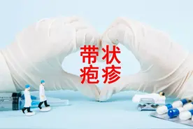 传说中的“蛇缠腰”到底是什么？十院科普官为您解读→图片