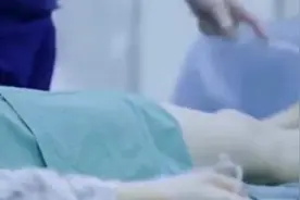 骨折后打钉子，无需二次手术取出了？可降解！我国首个医用镁合金接骨螺钉进入临床试验了图片