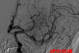 工作太忙忘了喝水？专家：喝水少是中风高发因素图片