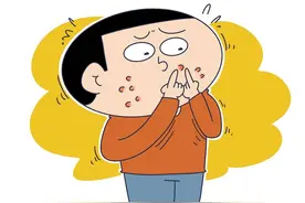 小伙因容貌焦虑患躯体变形障碍症，专家：该病多发于青少年群体图片