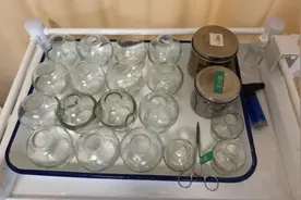 平衡火罐疗法：古老中医的智慧，现代生活的福音图片