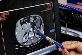 来自嘉定的细胞科技，为晚期癌症患者打开重生之门图片