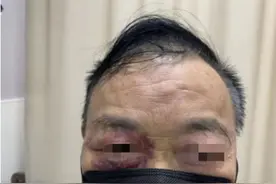 离奇！杭州大伯患怪病，一咳嗽就晕倒！很多人有这个习惯图片