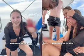 “我会死吗？”俄罗斯女歌手遭鲨鱼咬伤手，被咬后开始全身发抖图片