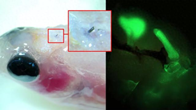 有机电极可实现无需手术的短期电疗