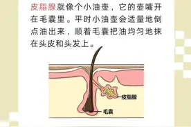 “医”图读懂｜听皮肤科医生的，一起摆脱“大油头”！图片