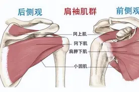科普｜肩袖损伤，你不知道的那些小知识图片