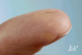 视力很好但青光眼晚期？眼科专家建议40岁体检要查眼压图片