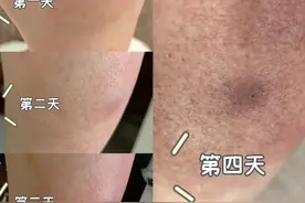 红火蚁已入侵12个省份，有致命危险！紧急提醒图片