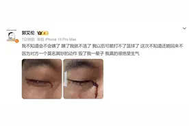 突发！知名运动员郭艾伦晒出眼部受伤照片，结膜受损还能恢复吗？图片