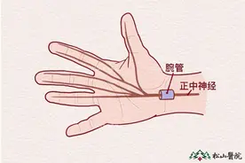 经常手麻？松山医院：可能是腕管综合征在找“麻”烦图片