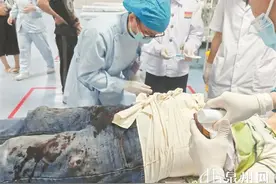 男子切割机误伤腹部 肠外露紧急抢救图片