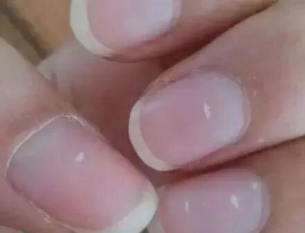 指甲上没有月牙，是我身体虚吗？
