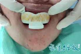 “医生，快救我!”福州女子深夜冲进医院求救！竟因在家做这事图片