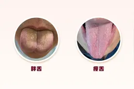体内有病，舌头先知？医生提醒：这些变化可能暗示脏腑出现疾病图片