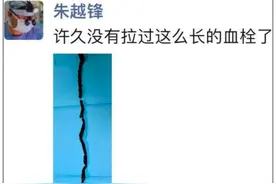 以为是腿痛，结果是血栓!老年人出现这些症状，千万别大意!图片
