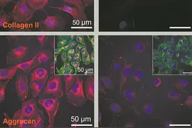 “跳舞分子”能快速修复软骨细胞图片
