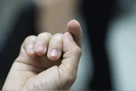 划伤手指被送进ICU！这些伤口不可大意→图片