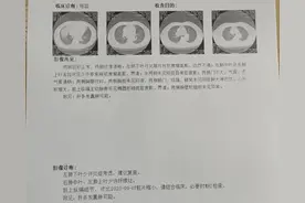 “平时身体不错啊！”男子被确诊，医生：有此症状赶紧就医……图片