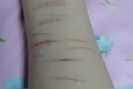 14岁女孩为啥用刀割自己？及时读懂这些信号，帮娃走出厌学阴霾图片