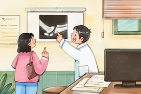 有的骨折可以不打石膏图片