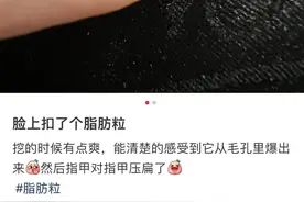 眼周围长满“脂肪粒”，挤出来很酸爽？图片