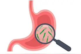 幽门螺杆菌感染有何症状？检出阳性后如何治疗？专家解答→图片