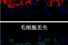 耳机党必看！这些习惯正在偷走你的听力……图片