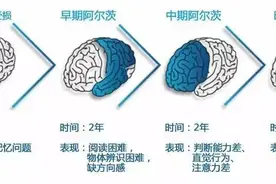 身边人爱说这几句口头禅，这是“老年痴呆”前兆！60秒即可自测！图片