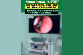 7岁男童鼻腔恶臭长达两年，找不到原因！“罪魁祸首”竟是一颗螺丝钉图片
