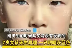 热闻|江西7岁女孩天生异瞳在校受欢迎，医生称为虹膜异色症，网友：好像小公主！图片