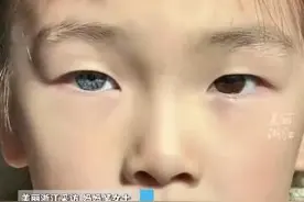 热闻|江西7岁女孩天生异瞳在校受欢迎，医生称为虹膜异色症，网友：好像小公主！图片