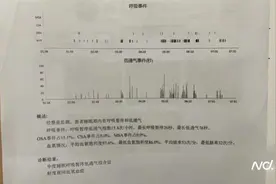 “囤健康”背后｜家用呼吸机、雾化机……哪些会是“智商税”？图片
